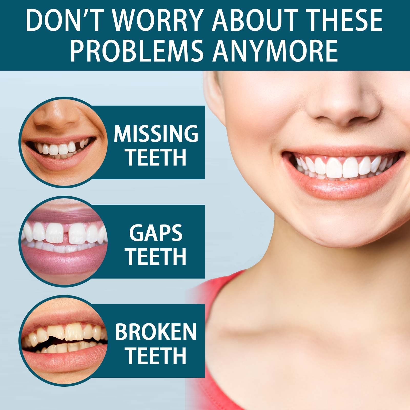 BrightSmile Snap-On Veneers