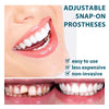 BrightSmile Snap-On Veneers