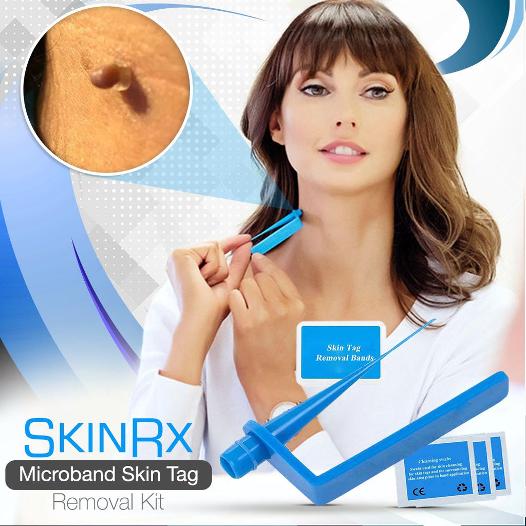 SkinRx Microband Skin Tag Removal Kit