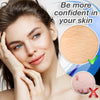 SkinRx Microband Skin Tag Removal Kit