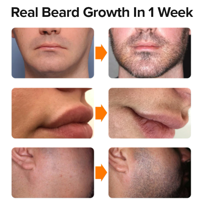 Beard Thickening Kit