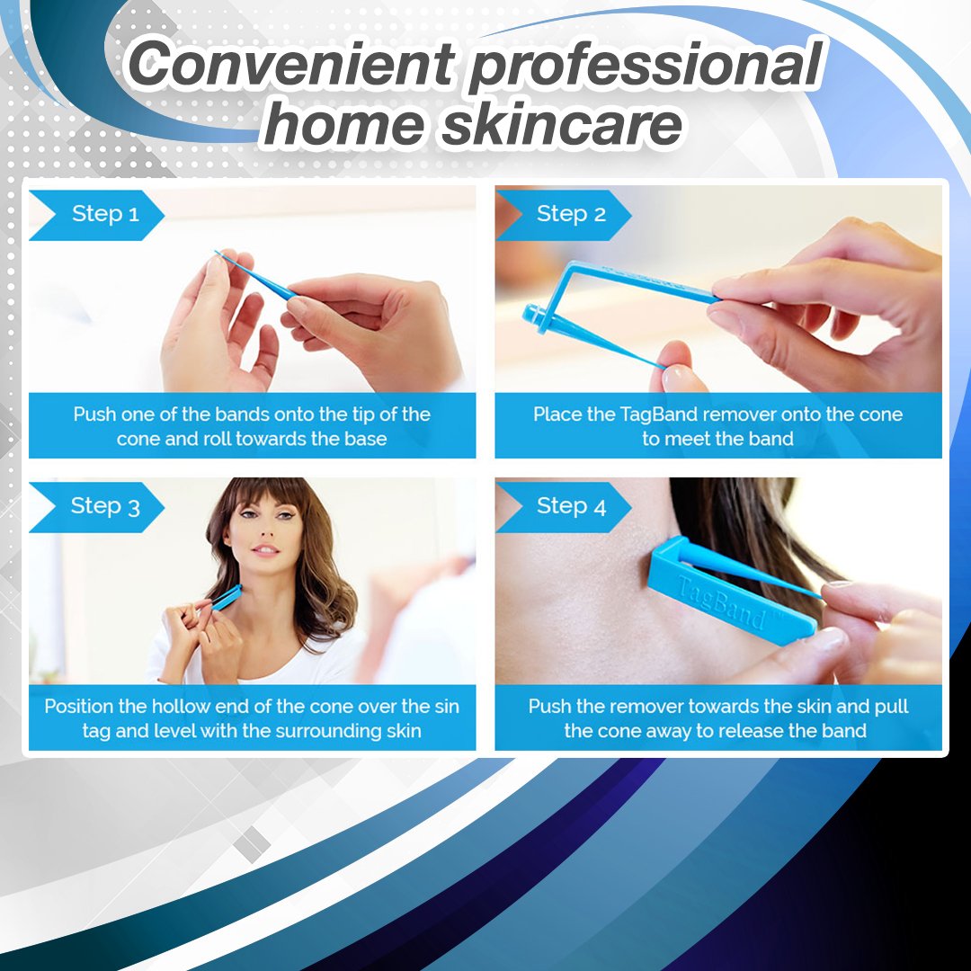 SkinRx Microband Skin Tag Removal Kit