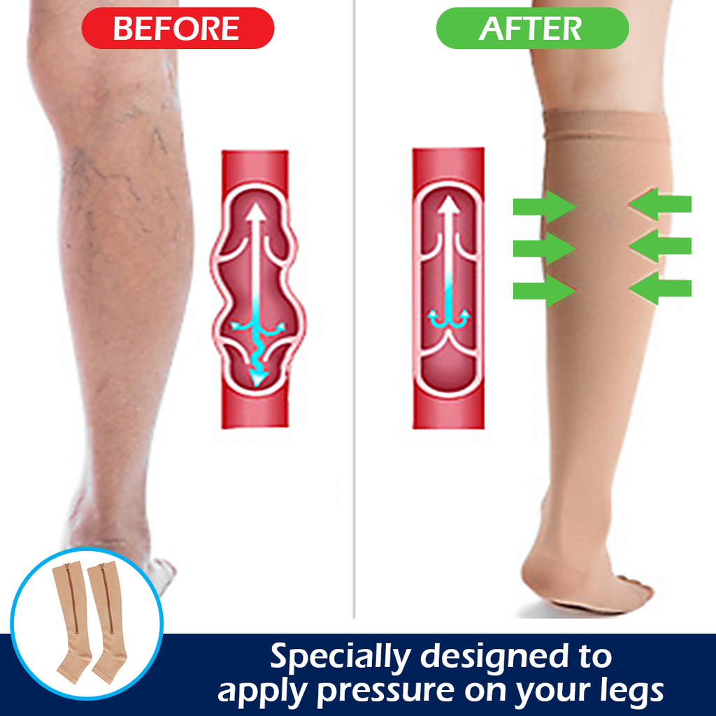 FeetFree 20-30mmHg Zippered Compression Socks