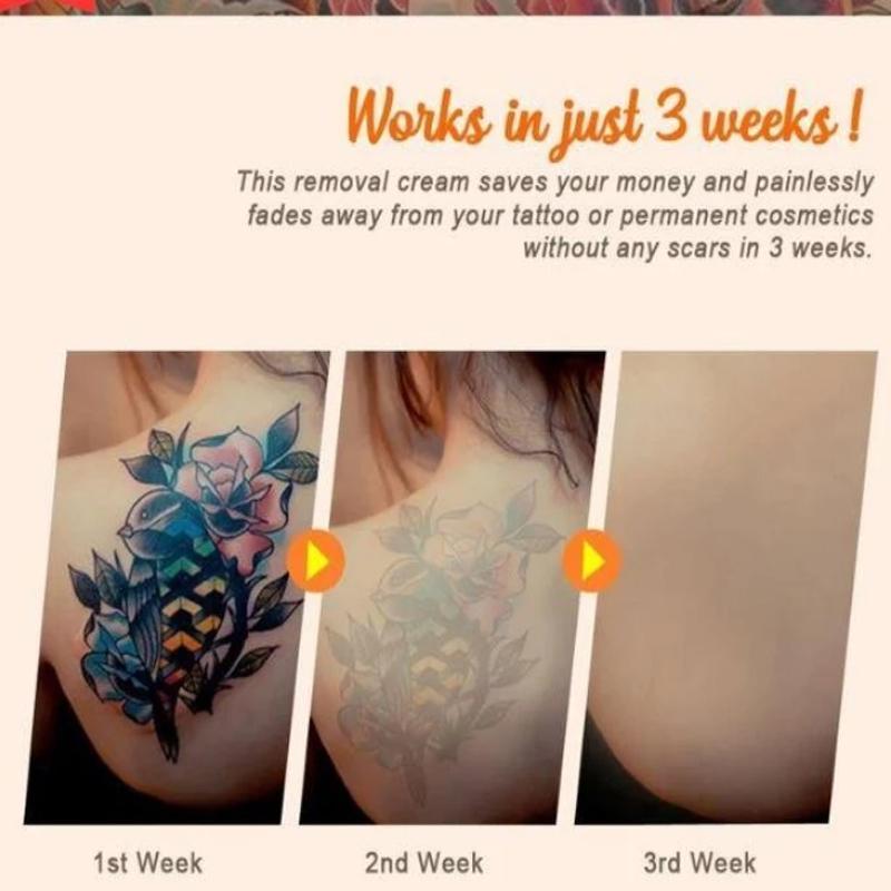 Permanent Tattoo Removal Cream