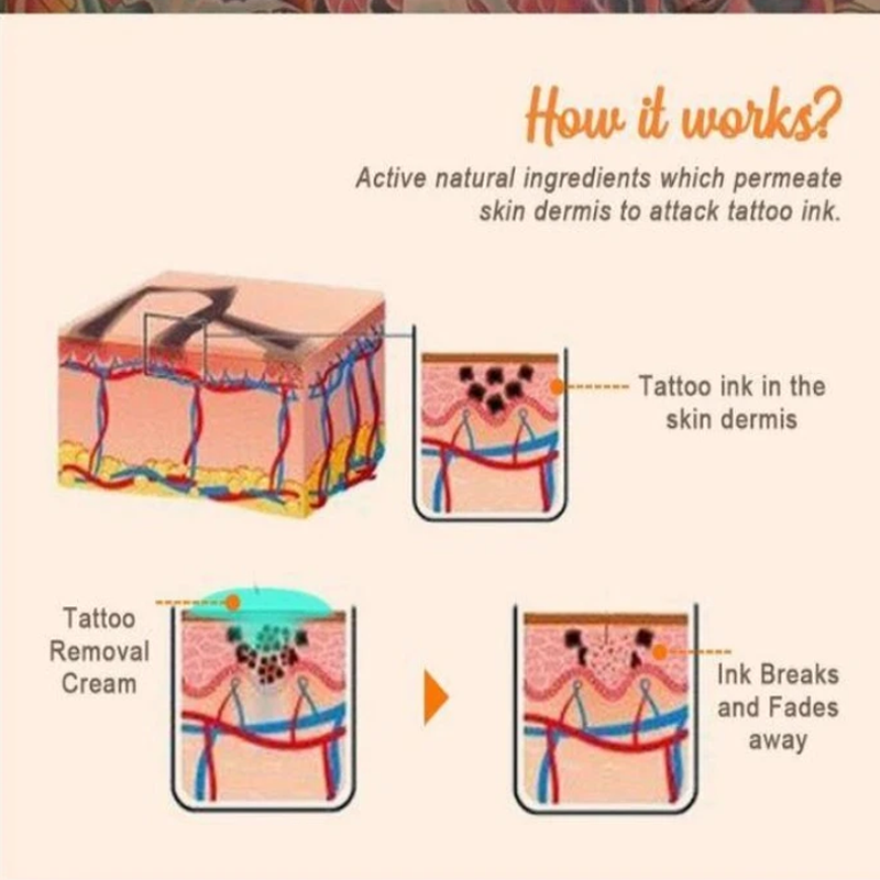 Permanent Tattoo Removal Cream