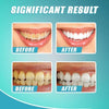 【LAST DAY PROMOTION】 - INTENSIVE STAIN REMOVAL WHITENING TOOTHPASTE
