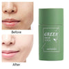 Green Tea Maximum Strength Acne Cleansing Stick