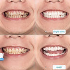 【LAST DAY PROMOTION】 - INTENSIVE STAIN REMOVAL WHITENING TOOTHPASTE